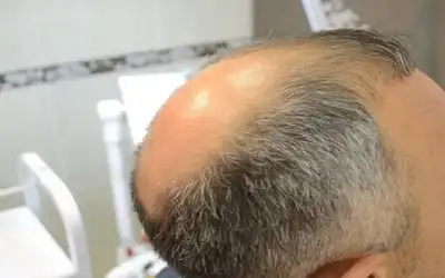 اكتشاف جديد يعطى الأمل في محاربة