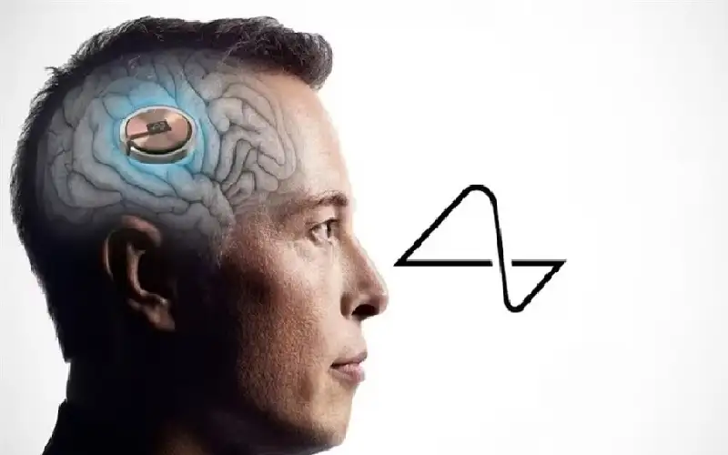 بعد ماسك.. الصين تعلن زرع شريحة