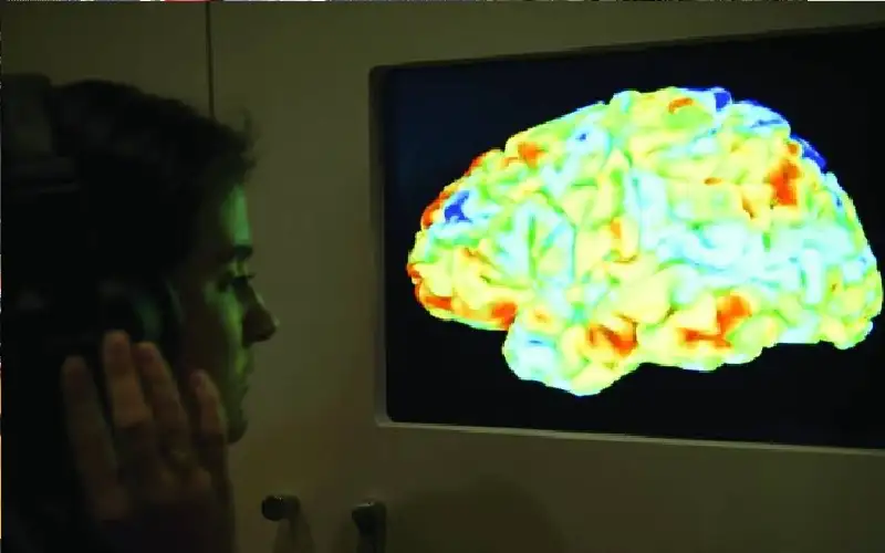 غرسة دماغية تحول الأفكار إلى كلام