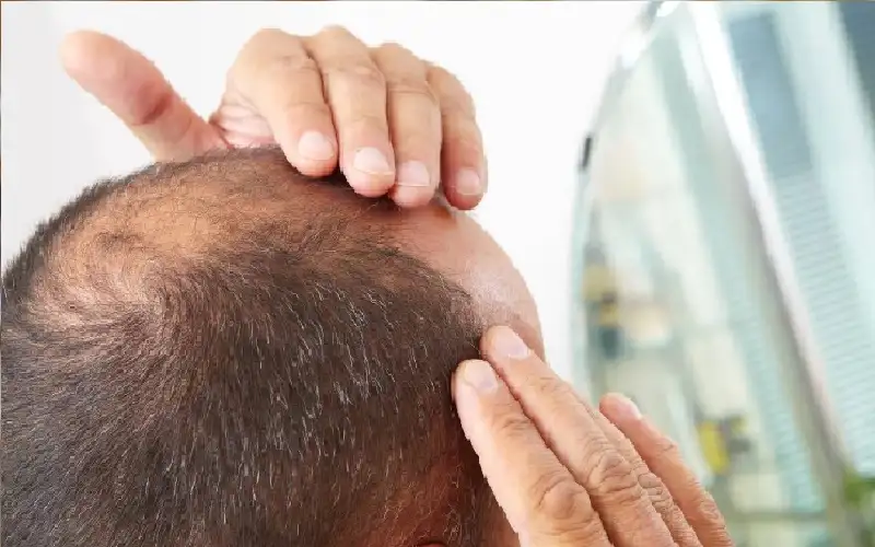 بروتين يمكنه علاج تساقط الشعر