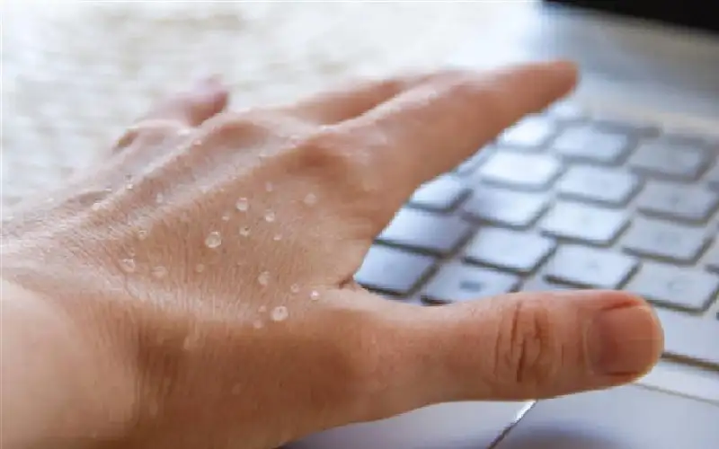 متى يكون فرط التعرق خطرا؟