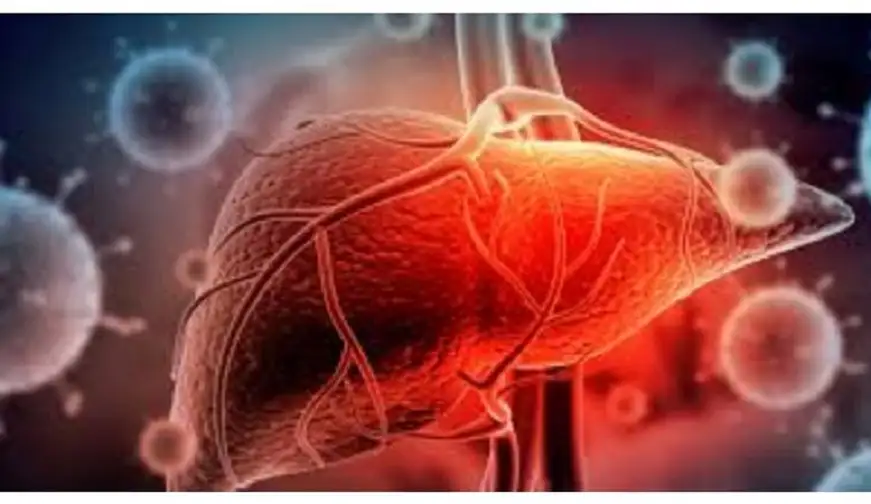 لجنة وطنية لتحديث استراتيجية الكبد الفيروسي