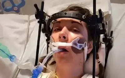 جراحة دقيقة تعيد جمجمة شابة إلى