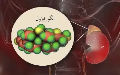 لماذا يرتفع الكورتيزول؟.. الأسباب والأعراض