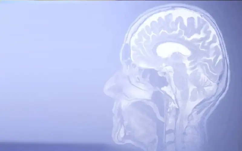 اختبار 4 أدوية للزهايمر لمعرفة أيها