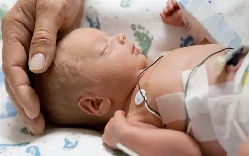 الولادة قبل 34 أسبوعا من الحمل