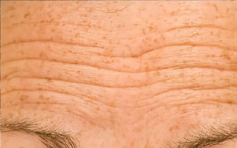 8 إجراءات بسيطة لمنع التجاعيد المبكرة