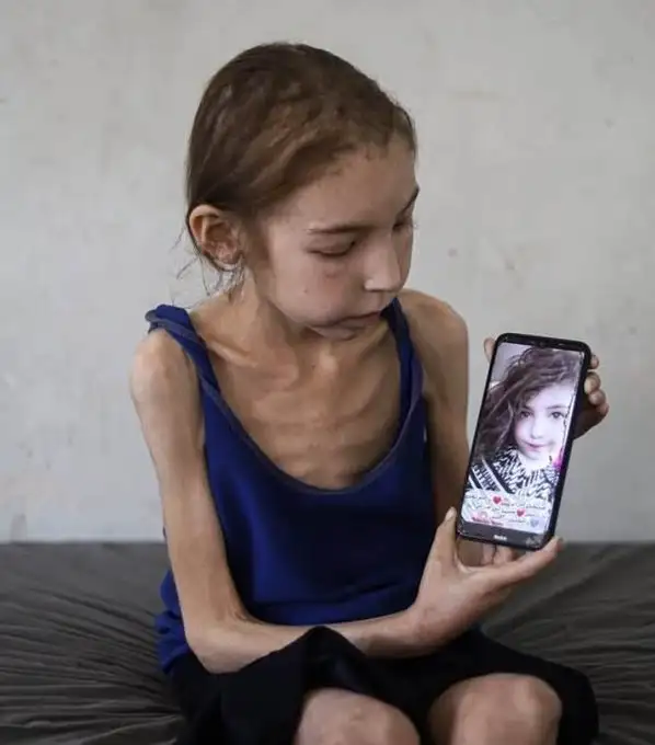 هذه رهف من غزة .. تشكو