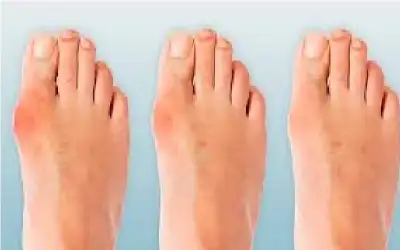 إصبع قدمك الكبير لا ينتفخ عبثا..