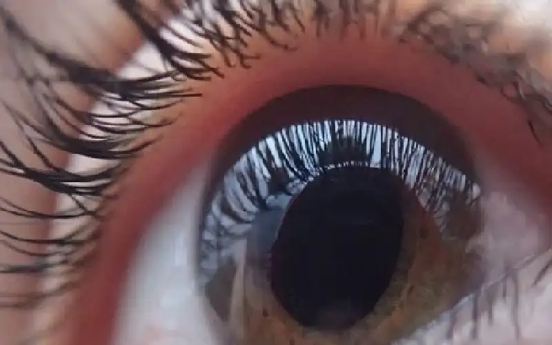 مكملات فيتامينات قد تبطئ تطور المياه