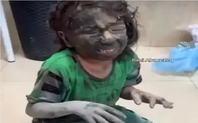 عن محرقة غزة