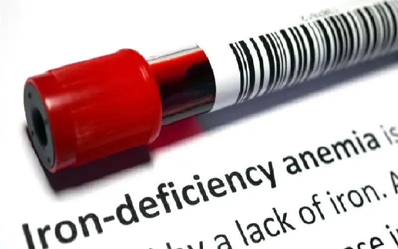 نقص الحديد يزيد احتمال الإصابة بسكتة
