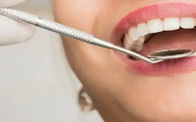 أمراض يسببها التهاب اللثة