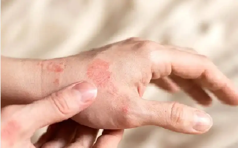 من صورة واحدة.. الذكاء الاصطناعي يقيم