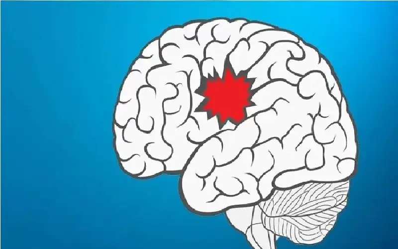 تبدأ بدوخة خفيفة.. علامة غير معروفة