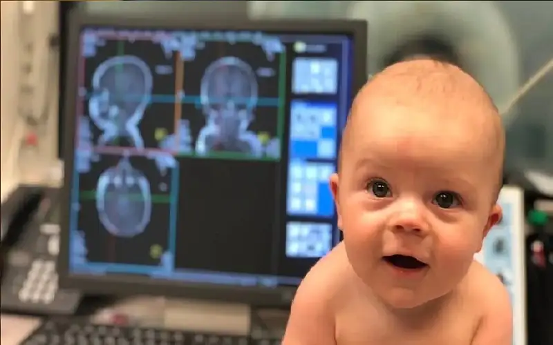 الذكاء الاصطناعي يقدر عمر دماغ الرضيع
