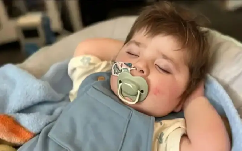 ضمن 16 حالة فقط في العالم..