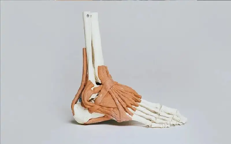 دراسة: نجاح بارز لطريقة استبدال الكاحل