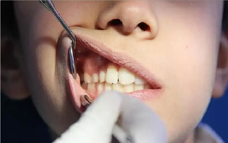 فمك مرآة لحالتك النفسية.. دراسة تربط