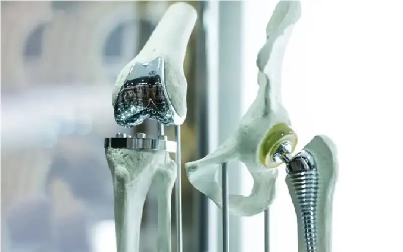 سبائك معدنية قابلة للتحلل تصلح كسور