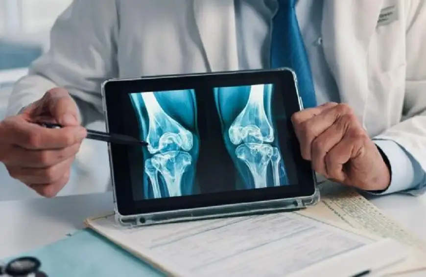 أغذية تحمينا من كسور العظام عند