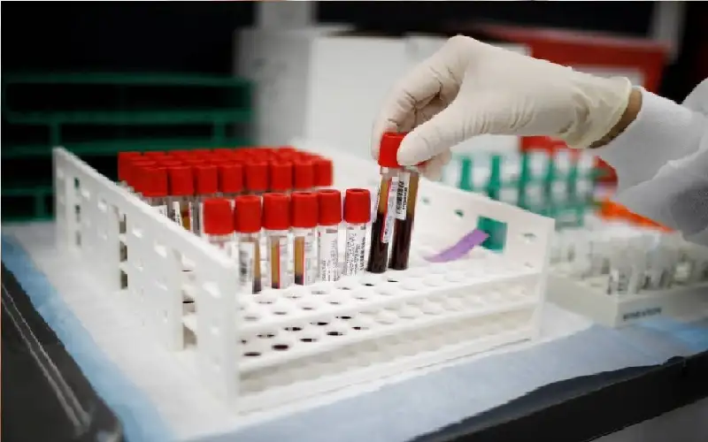 تحليل جديد للدم قد يقلل من