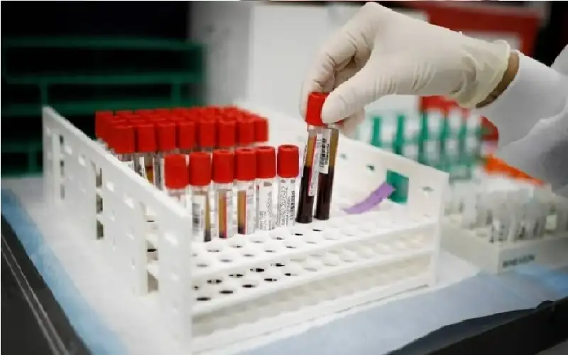 أمل جديد لمرضى الكبد.. فحص دم