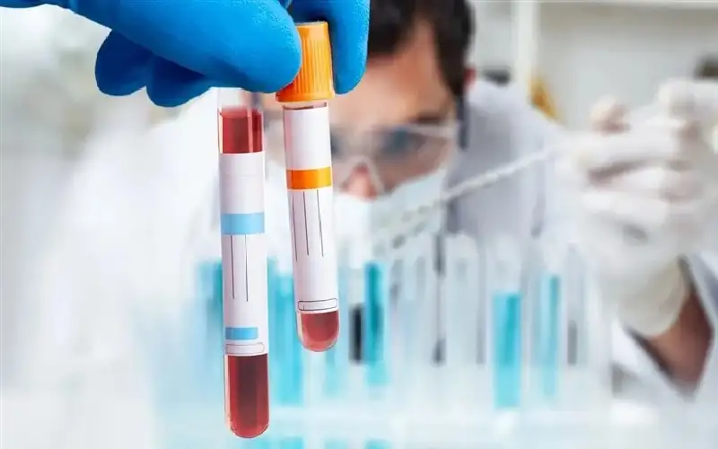 اختبار لمقاومة الإنسولين يكشف خطر الزهايمر