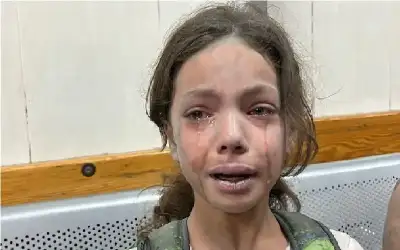 معظمهم اطفال.. 70 شهيدا و332 إصابة