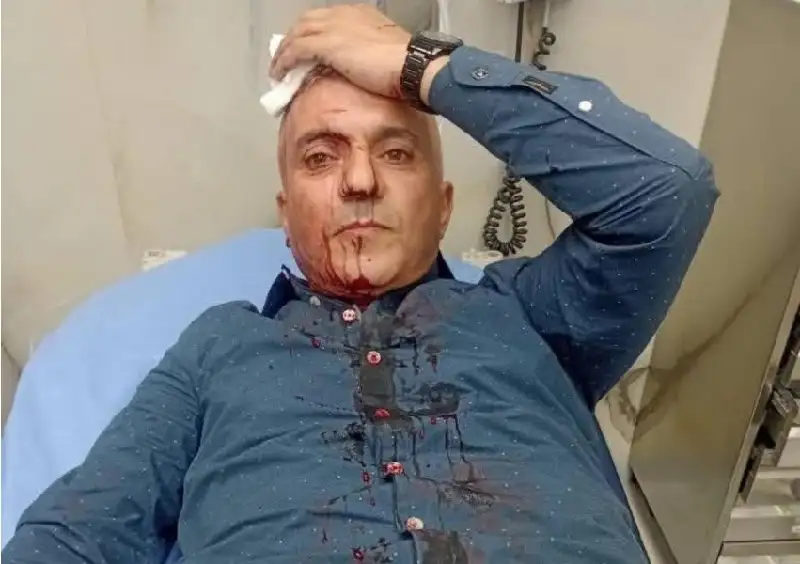 اعتداء على الزميل فارس الحباشنة من