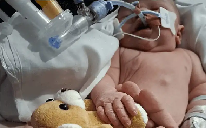 وضعت رضيعتها وحيدة وماتت بين يديها..