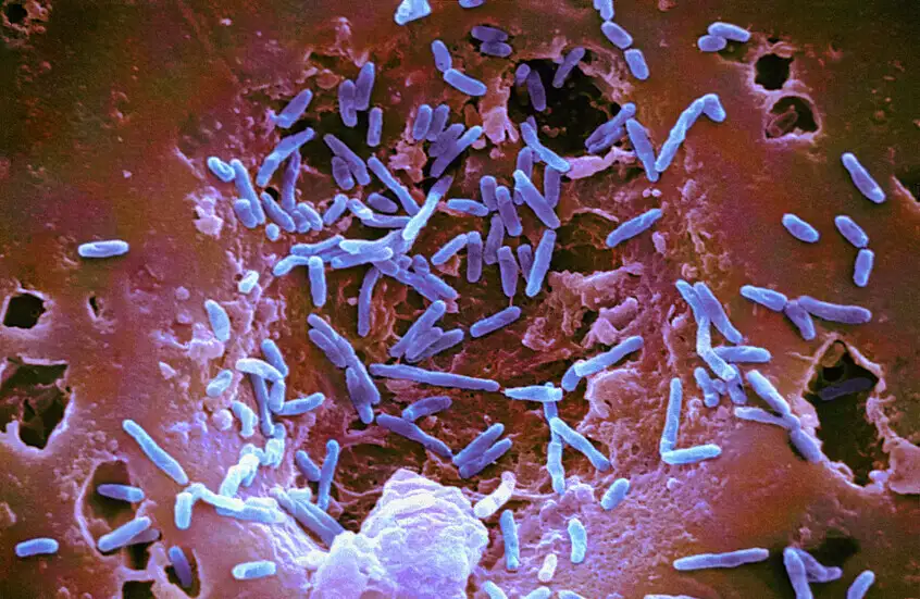 اكتشاف بكتيريا تعزز العلاج المناعي للسرطان