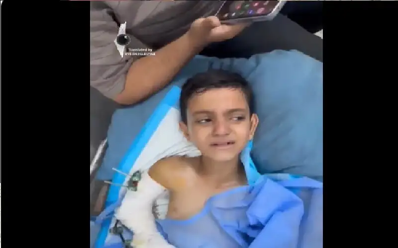 طفل غزاوي مصاب يبكي الجوع