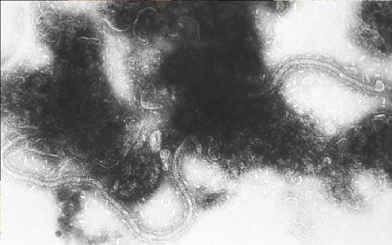 اللقاح ضد الفيروس المخلوي للحوامل يحمي