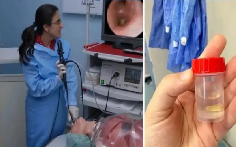 سيدة كادت تفقد حياتها بسبب وجبة