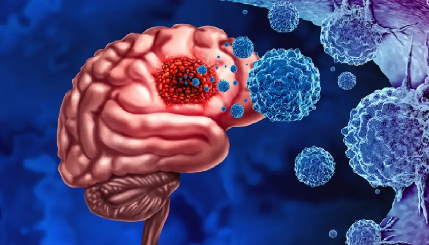 حقق نتائج مذهلة وأزال الورم تماما..