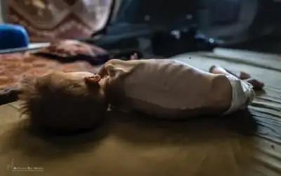 المجاعة تتفاقم .. استشهاد الطفل عبد