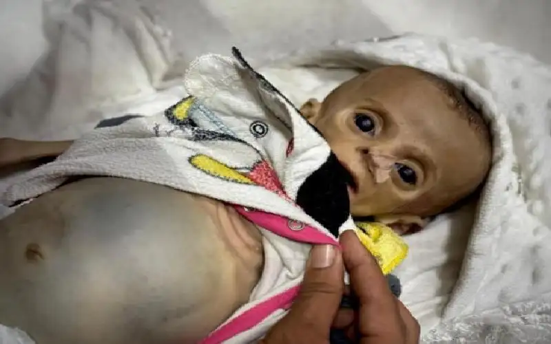 استشهاد رضيعة في خانيونس بسبب التجويع