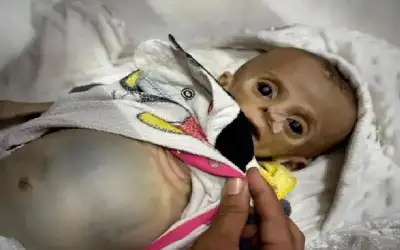 استشهاد رضيعة في خانيونس بسبب التجويع