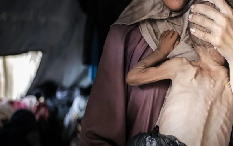 10 شهداء تجويعا بغزة خلال 24