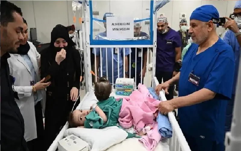 في عملية معقدة بالرياض.. نجاح فصل