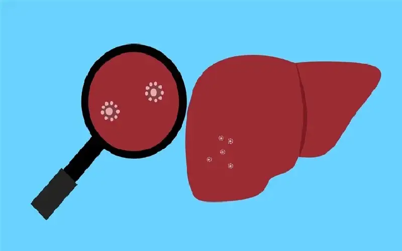 حقائق جديدة عن احتمالات الوقاية من