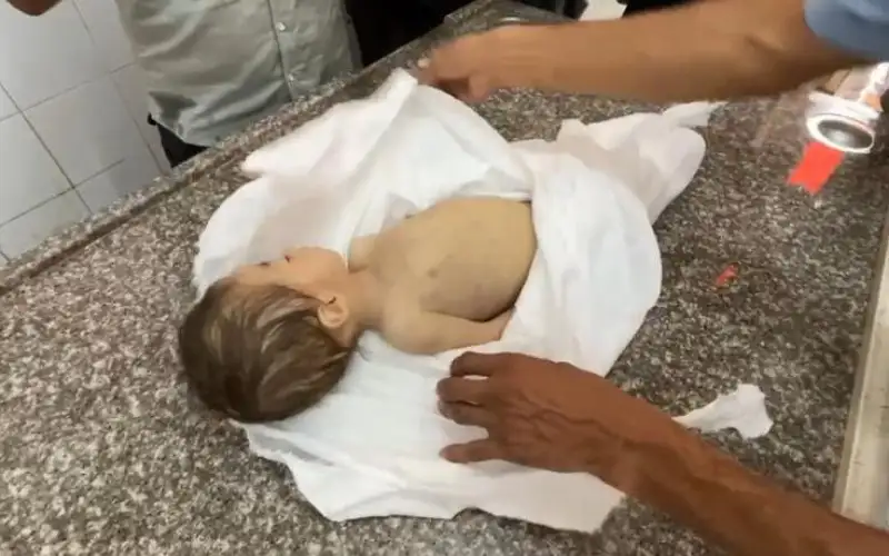 وفاة طفلة بسبب الجوع في قطاع