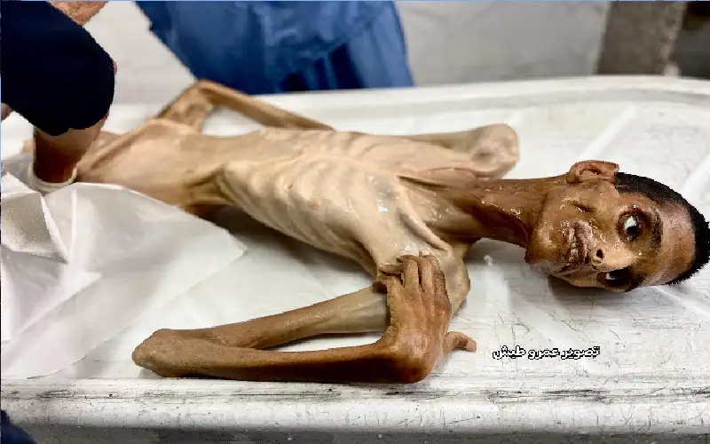 وفاة الشاب عادل ماضي في رفح