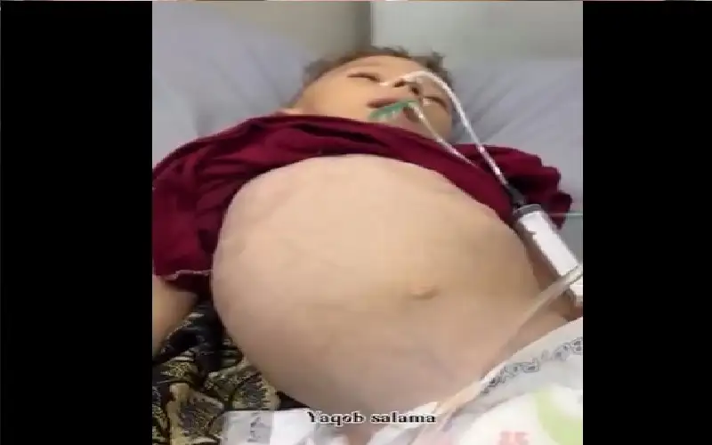 عن طفل غزة.. سيف حلس