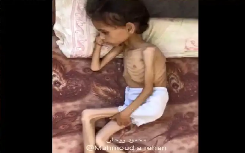 هذه الطفلة من غزة.. ليست جائعة..