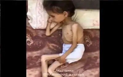 هذه الطفلة من غزة.. ليست جائعة..