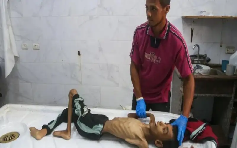 تصاعد خطير في حالات الشلل الرخو