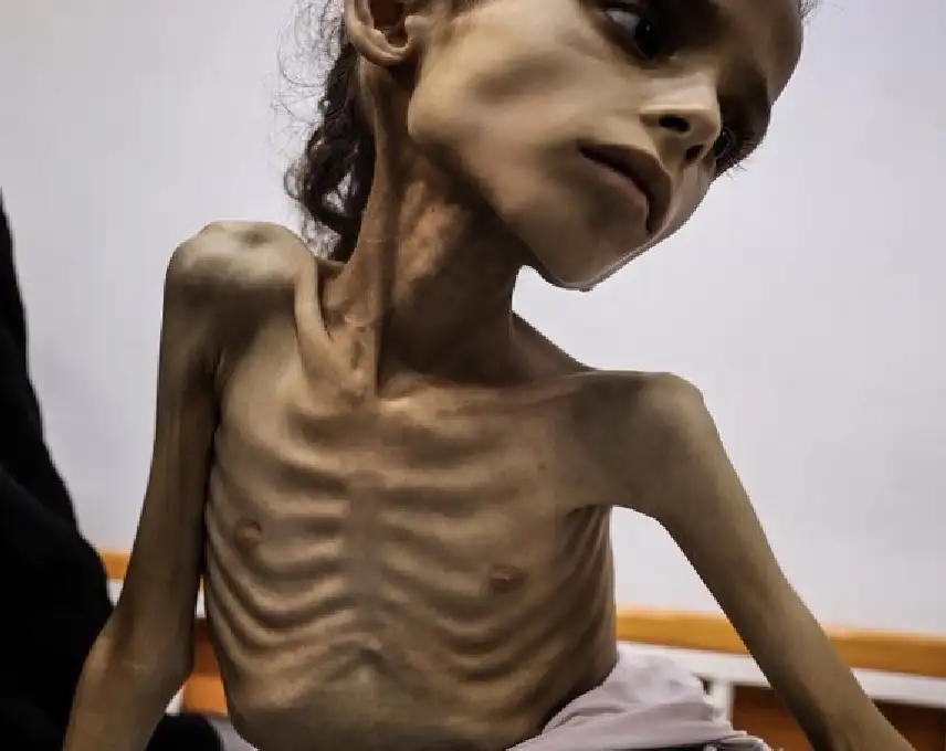 اكمل الفراغ.. غزة التي لا تجد..