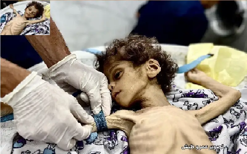 غزة.. وفاة الطفلة رؤى ماشي داخل